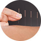 img-acupuncture